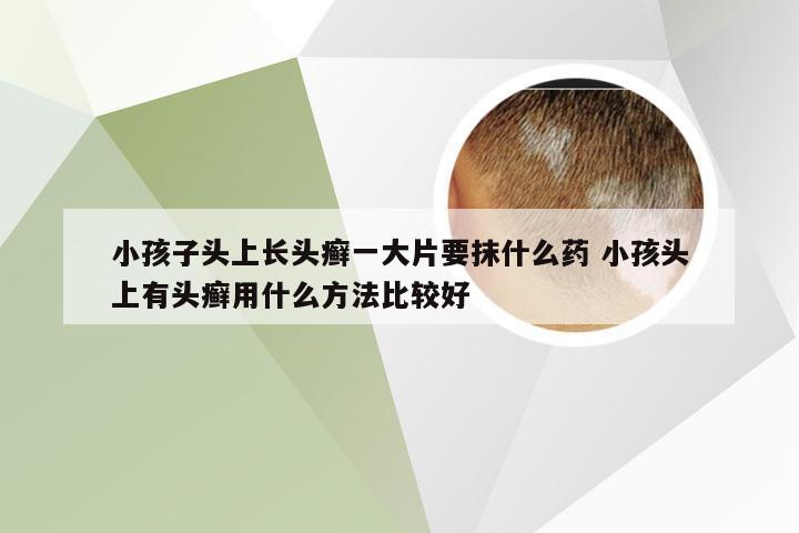 小孩子头上长头癣一大片要抹什么药 小孩头上有头癣用什么方法比较好