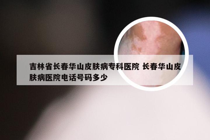 吉林省长春华山皮肤病专科医院 长春华山皮肤病医院电话号码多少