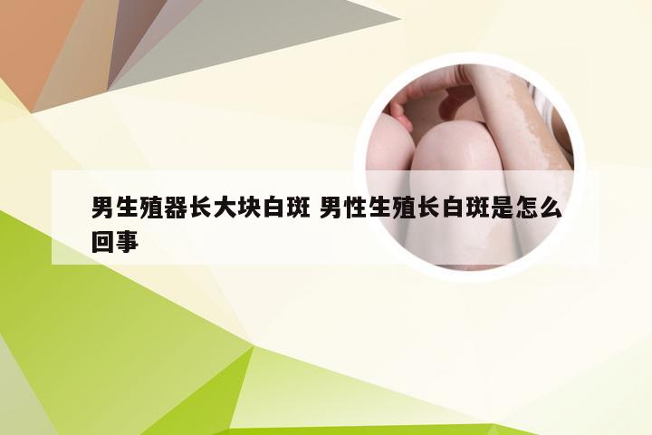 男生殖器长大块白斑 男性生殖长白斑是怎么回事