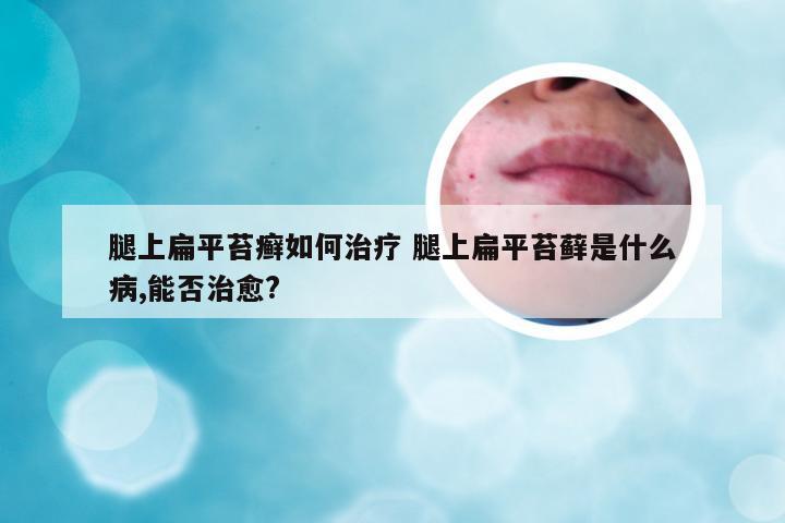 腿上扁平苔癣如何治疗 腿上扁平苔藓是什么病,能否治愈?