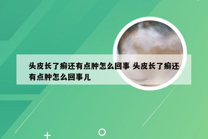 头皮长了癣还有点肿怎么回事 头皮长了癣还有点肿怎么回事儿