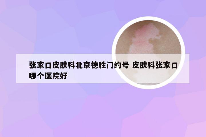 张家口皮肤科北京德胜门约号 皮肤科张家口哪个医院好