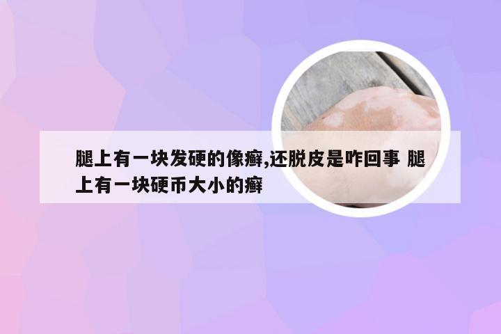 腿上有一块发硬的像癣,还脱皮是咋回事 腿上有一块硬币大小的癣