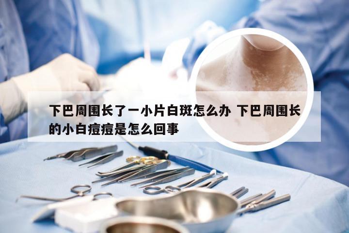 下巴周围长了一小片白斑怎么办 下巴周围长的小白痘痘是怎么回事