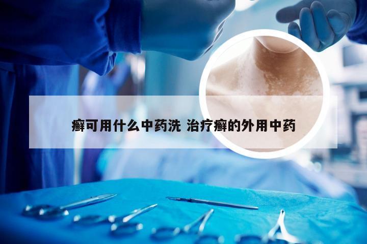 癣可用什么中药洗 治疗癣的外用中药