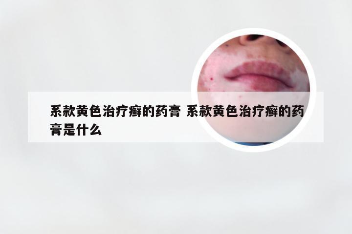 系款黄色治疗癣的药膏 系款黄色治疗癣的药膏是什么