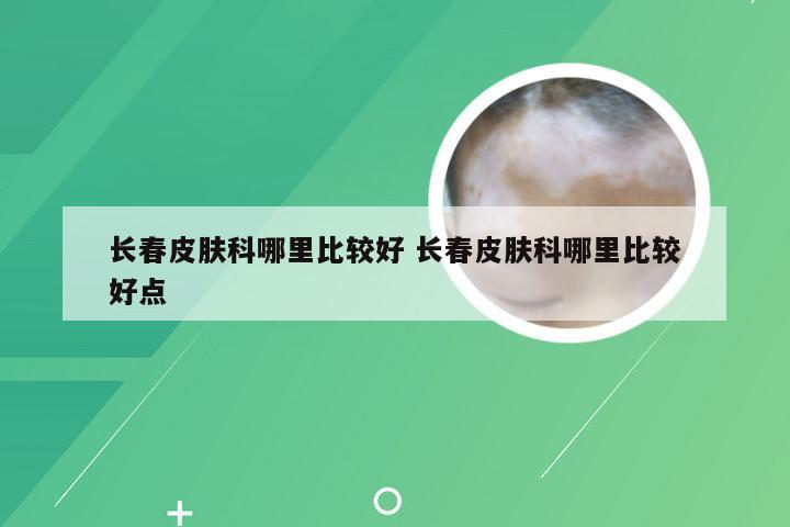 长春皮肤科哪里比较好 长春皮肤科哪里比较好点