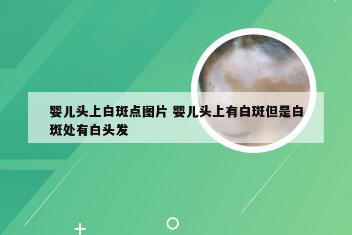 婴儿头上白斑点图片 婴儿头上有白斑但是白斑处有白头发