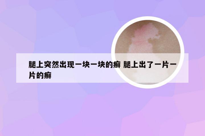 腿上突然出现一块一块的癣 腿上出了一片一片的癣