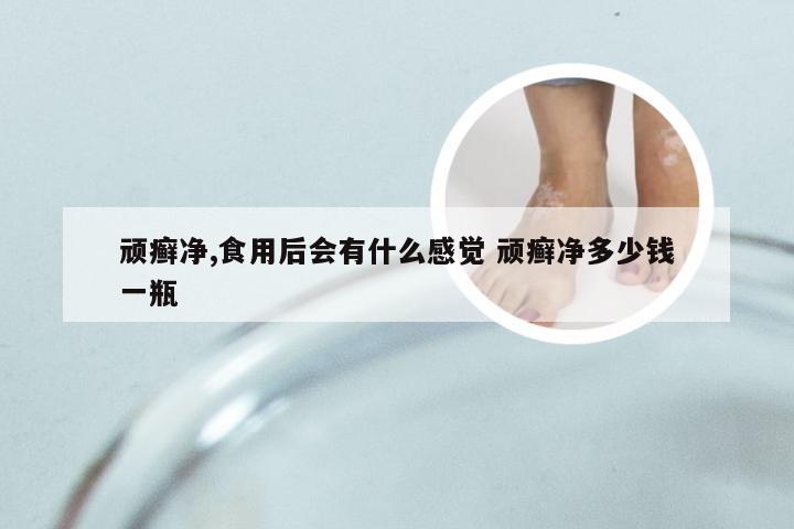 顽癣净,食用后会有什么感觉 顽癣净多少钱一瓶