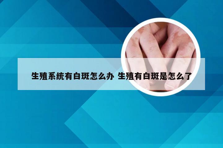 生殖系统有白斑怎么办 生殖有白斑是怎么了