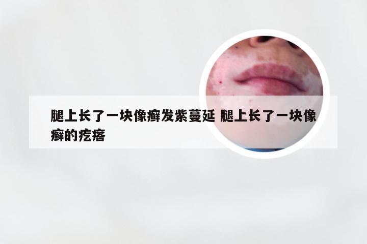 腿上长了一块像癣发紫蔓延 腿上长了一块像癣的疙瘩