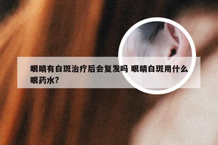 眼睛有白斑治疗后会复发吗 眼睛白斑用什么眼药水?