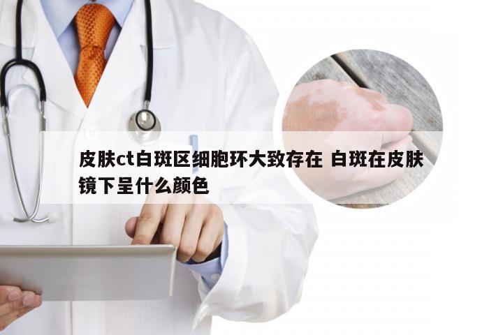 皮肤ct白斑区细胞环大致存在 白斑在皮肤镜下呈什么颜色