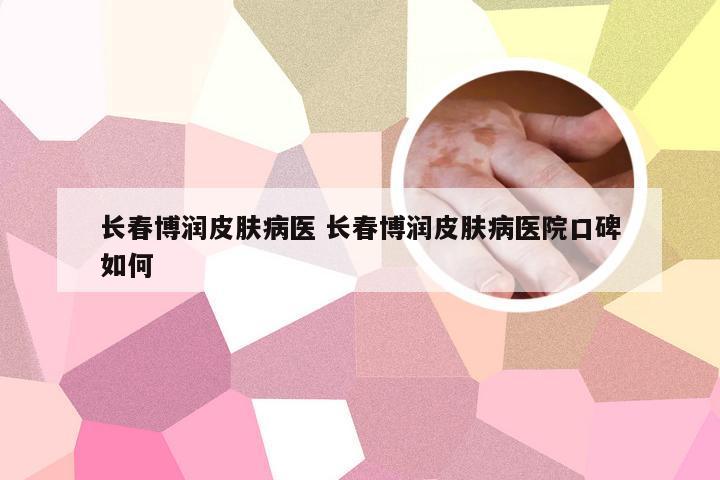 长春博润皮肤病医 长春博润皮肤病医院口碑如何