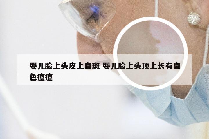 婴儿脸上头皮上白斑 婴儿脸上头顶上长有白色痘痘