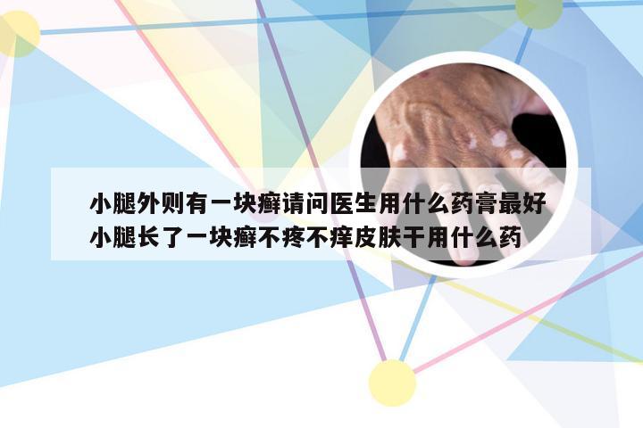 小腿外则有一块癣请问医生用什么药膏最好 小腿长了一块癣不疼不痒皮肤干用什么药