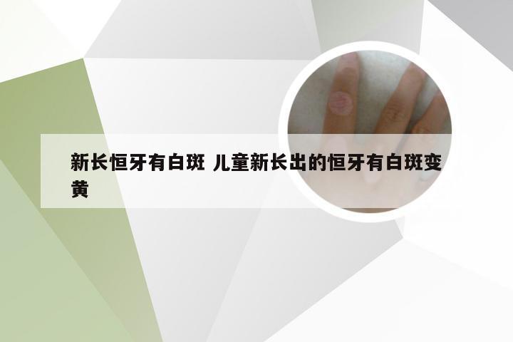 新长恒牙有白斑 儿童新长出的恒牙有白斑变黄