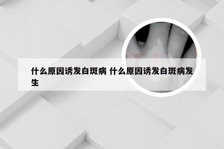 什么原因诱发白斑病 什么原因诱发白斑病发生