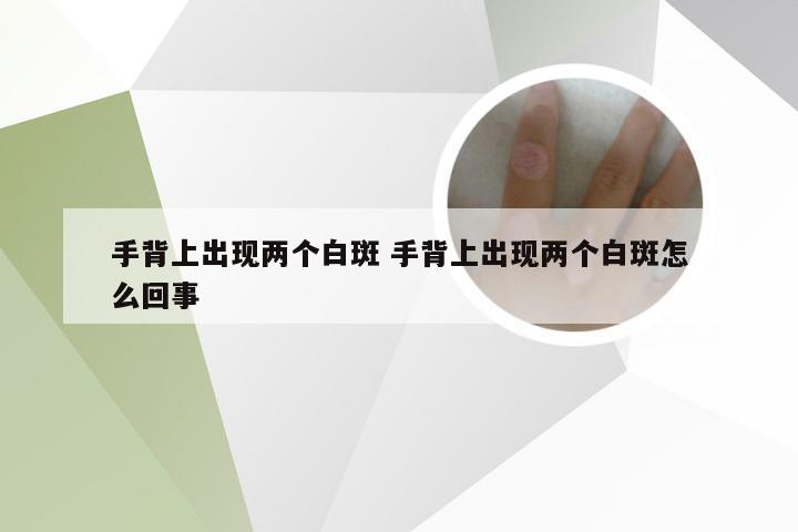 手背上出现两个白斑 手背上出现两个白斑怎么回事