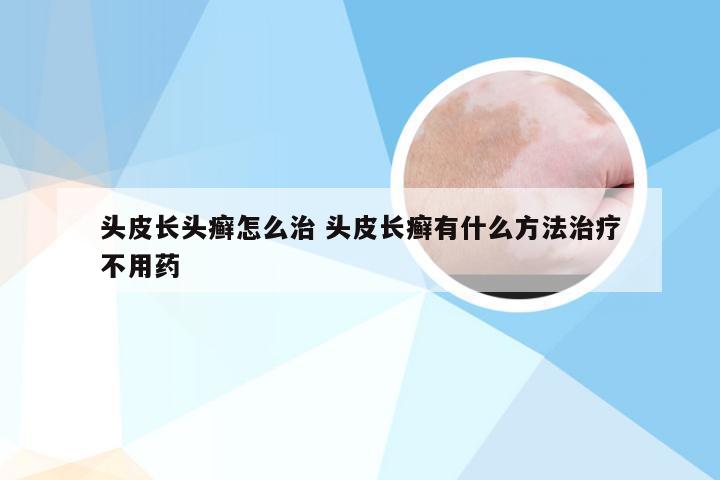 头皮长头癣怎么治 头皮长癣有什么方法治疗不用药