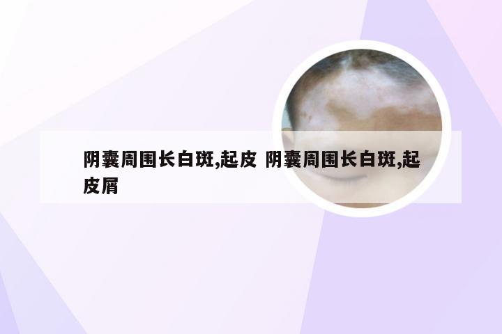 阴囊周围长白斑,起皮 阴囊周围长白斑,起皮屑