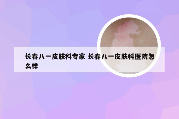 长春八一皮肤科专家 长春八一皮肤科医院怎么样