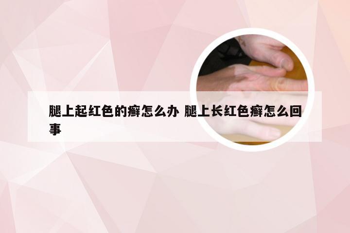 腿上起红色的癣怎么办 腿上长红色癣怎么回事