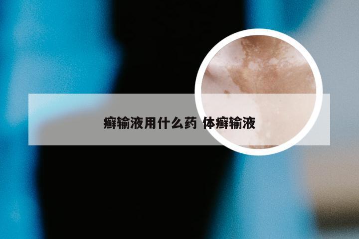 癣输液用什么药 体癣输液