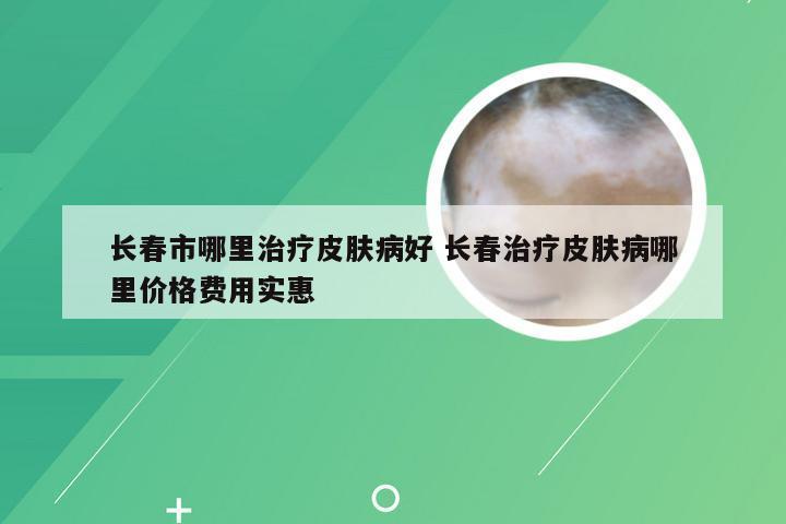 长春市哪里治疗皮肤病好 长春治疗皮肤病哪里价格费用实惠