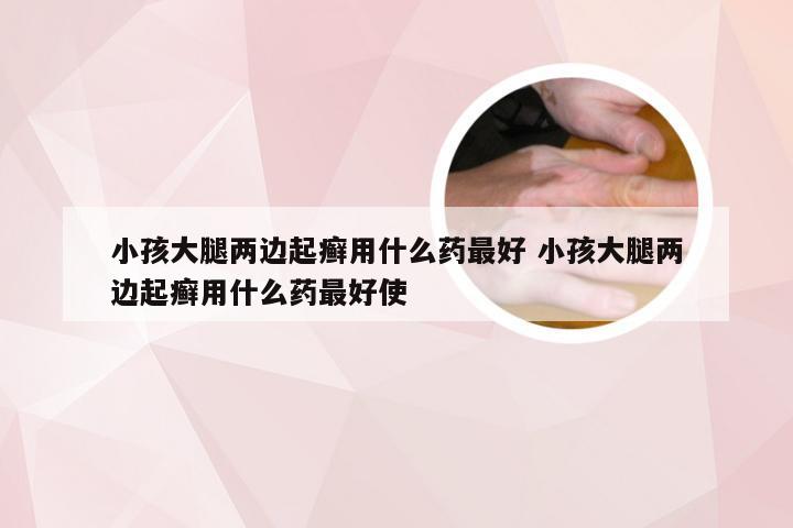 小孩大腿两边起癣用什么药最好 小孩大腿两边起癣用什么药最好使