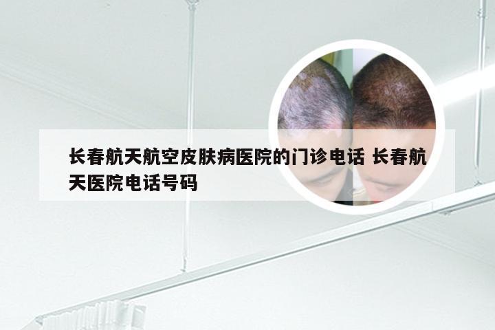 长春航天航空皮肤病医院的门诊电话 长春航天医院电话号码