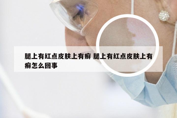 腿上有红点皮肤上有癣 腿上有红点皮肤上有癣怎么回事