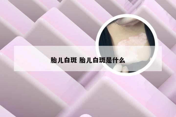 胎儿白斑 胎儿白斑是什么