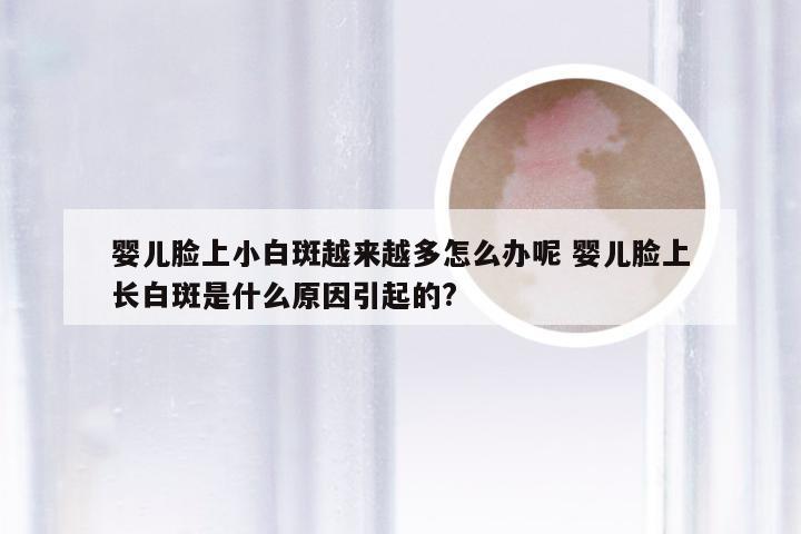 婴儿脸上小白斑越来越多怎么办呢 婴儿脸上长白斑是什么原因引起的?