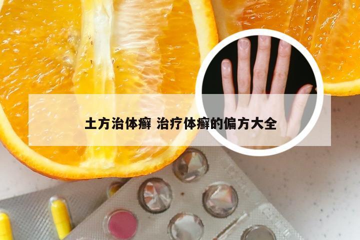 土方治体癣 治疗体癣的偏方大全