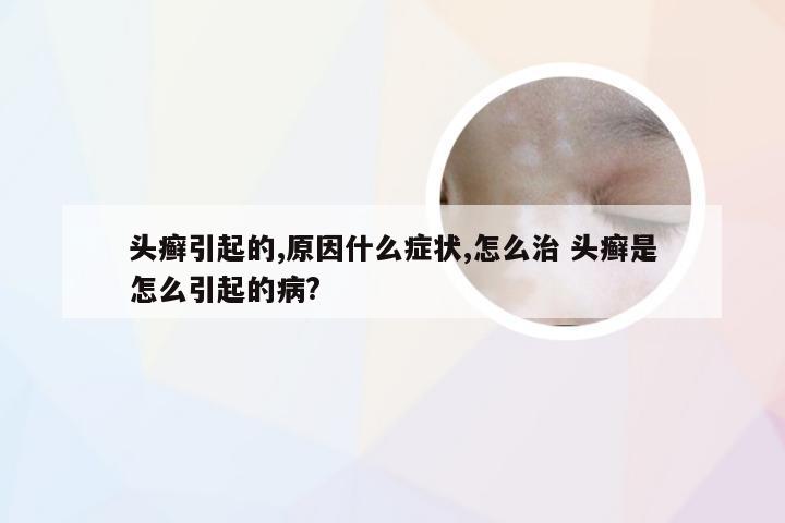 头癣引起的,原因什么症状,怎么治 头癣是怎么引起的病?