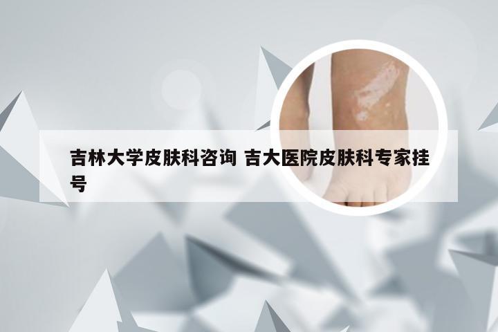 吉林大学皮肤科咨询 吉大医院皮肤科专家挂号