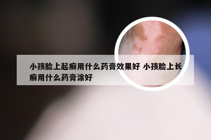 小孩脸上起癣用什么药膏效果好 小孩脸上长癣用什么药膏涂好