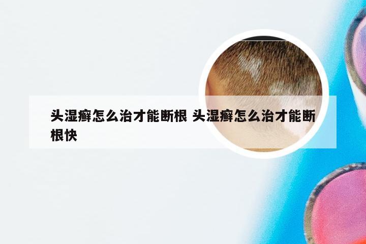 头湿癣怎么治才能断根 头湿癣怎么治才能断根快