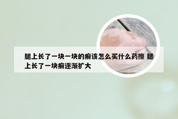 腿上长了一块一块的癣该怎么买什么药擦 腿上长了一块癣逐渐扩大