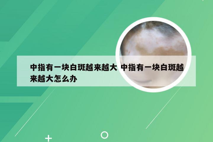 中指有一块白斑越来越大 中指有一块白斑越来越大怎么办