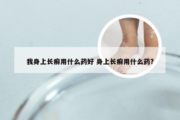 我身上长癣用什么药好 身上长癣用什么药?