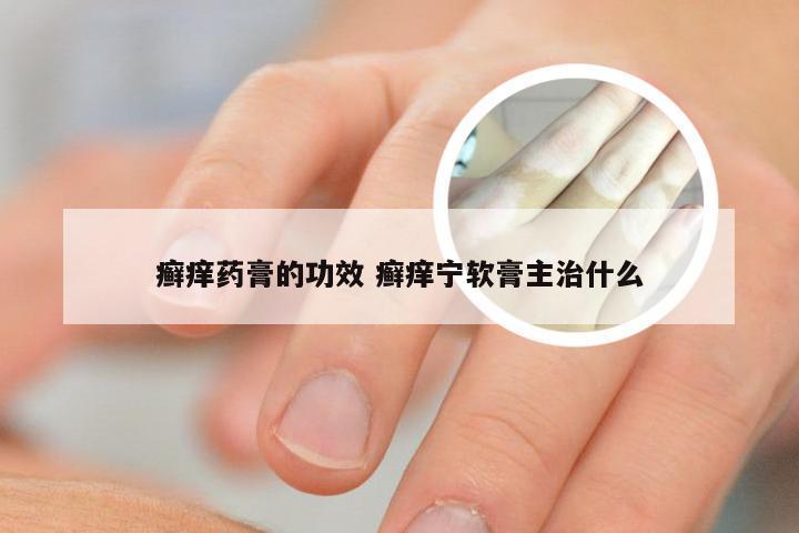 癣痒药膏的功效 癣痒宁软膏主治什么