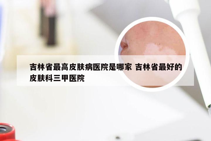 吉林省最高皮肤病医院是哪家 吉林省最好的皮肤科三甲医院