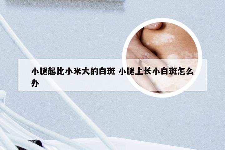 小腿起比小米大的白斑 小腿上长小白斑怎么办