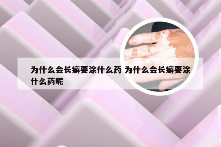 为什么会长癣要涂什么药 为什么会长癣要涂什么药呢