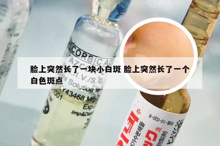 脸上突然长了一块小白斑 脸上突然长了一个白色斑点