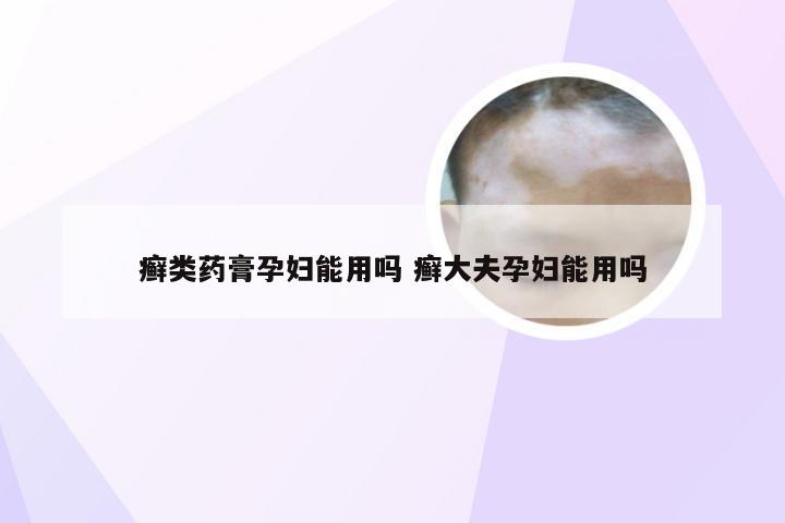 癣类药膏孕妇能用吗 癣大夫孕妇能用吗