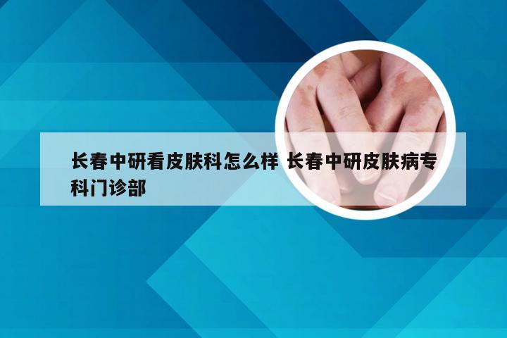 长春中研看皮肤科怎么样 长春中研皮肤病专科门诊部